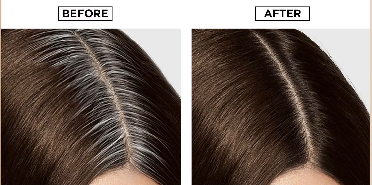 Root touch-up example